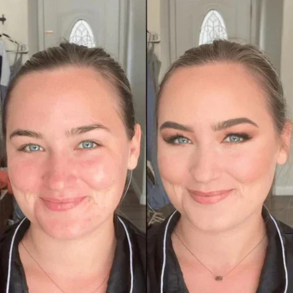 Mia foundation result